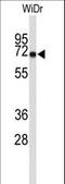 Mitochondrial import receptor subunit TOM70 antibody, LS-C160112, Lifespan Biosciences, Western Blot image 