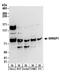 WRN Helicase Interacting Protein 1 antibody, A301-389A, Bethyl Labs, Western Blot image 