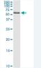 Zinc Finger Protein 100 antibody, H00163227-M01-100ug, Novus Biologicals, Western Blot image 