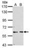 Cyclin Dependent Kinase 16 antibody, NBP2-19732, Novus Biologicals, Western Blot image 
