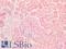 Insulin Receptor antibody, LS-A9423, Lifespan Biosciences, Immunohistochemistry paraffin image 