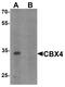 Chromobox 4 antibody, LS-C153640, Lifespan Biosciences, Western Blot image 