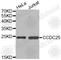 Coiled-Coil Domain Containing 25 antibody, A3449, ABclonal Technology, Western Blot image 