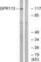 G-protein coupled receptor PGR23 antibody, LS-C120676, Lifespan Biosciences, Western Blot image 