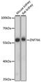 Zinc Finger Protein 766 antibody, A15925, ABclonal Technology, Western Blot image 
