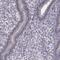 Chromosome 10 Open Reading Frame 62 antibody, PA5-67264, Invitrogen Antibodies, Immunohistochemistry frozen image 