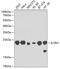 Interleukin 1 Receptor Antagonist antibody, GTX32673, GeneTex, Western Blot image 