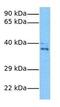 Cyclin G2 antibody, GTX77670, GeneTex, Western Blot image 