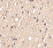 Sprouty Related EVH1 Domain Containing 1 antibody, 4833, ProSci, Immunohistochemistry paraffin image 