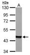 Mevalonate Diphosphate Decarboxylase antibody, NBP1-33050, Novus Biologicals, Western Blot image 