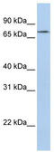 Regulator Of Microtubule Dynamics 2 antibody, TA340361, Origene, Western Blot image 