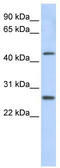 PRAME Family Member 10 antibody, TA334974, Origene, Western Blot image 