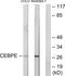 CCAAT Enhancer Binding Protein Epsilon antibody, PA5-38616, Invitrogen Antibodies, Western Blot image 