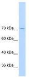 GTF2I Repeat Domain Containing 1 antibody, TA345203, Origene, Western Blot image 