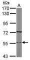 Cholinergic Receptor Nicotinic Beta 2 Subunit antibody, GTX113654, GeneTex, Western Blot image 