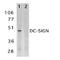 CD209 antigen antibody, PA1-30119, Invitrogen Antibodies, Western Blot image 