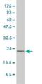 Mitotic Arrest Deficient 2 Like 1 antibody, H00004085-M01, Novus Biologicals, Western Blot image 