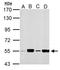 Malonyl-CoA Decarboxylase antibody, LS-C186124, Lifespan Biosciences, Western Blot image 