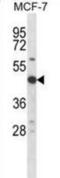 Ribosomal Protein S6 Kinase B2 antibody, abx028422, Abbexa, Western Blot image 