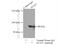 STAT3 antibody, 60199-1-Ig, Proteintech Group, Immunoprecipitation image 