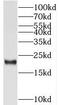 Transmembrane P24 Trafficking Protein 10 antibody, FNab08803, FineTest, Western Blot image 