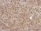 Proteasome 26S Subunit, Non-ATPase 6 antibody, NBP2-19987, Novus Biologicals, Immunohistochemistry frozen image 