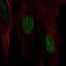 Heat Shock Protein Family B (Small) Member 7 antibody, PA5-55670, Invitrogen Antibodies, Immunofluorescence image 