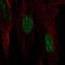 Heat Shock Protein Family B (Small) Member 7 antibody, PA5-55670, Invitrogen Antibodies, Immunofluorescence image 