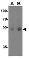 Dopa Decarboxylase antibody, GTX31550, GeneTex, Western Blot image 