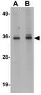 Arginine And Serine Rich Coiled-Coil 1 antibody, GTX85206, GeneTex, Western Blot image 