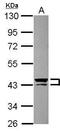 Keratin 13 antibody, PA5-29120, Invitrogen Antibodies, Western Blot image 