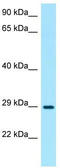 TNFAIP3 Interacting Protein 3 antibody, TA338308, Origene, Western Blot image 