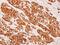 Keratin 8 antibody, PA5-29607, Invitrogen Antibodies, Immunohistochemistry frozen image 