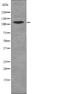 EPH Receptor B6 antibody, abx215193, Abbexa, Western Blot image 
