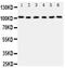 Minichromosome Maintenance Complex Component 2 antibody, PA1711, Boster Biological Technology, Western Blot image 