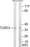 Tumor Suppressor Candidate 3 antibody, EKC1797, Boster Biological Technology, Western Blot image 