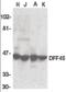 DNA Fragmentation Factor Subunit Alpha antibody, orb86756, Biorbyt, Western Blot image 