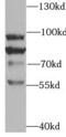 Transient Receptor Potential Cation Channel Subfamily V Member 4 antibody, FNab09028, FineTest, Western Blot image 
