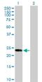 Kinesin Family Member 26A antibody, H00026153-D01P, Novus Biologicals, Western Blot image 