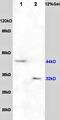 Nerve Growth Factor Receptor antibody, orb11125, Biorbyt, Western Blot image 