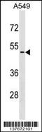 Cyclin Dependent Kinase Like 4 antibody, 59-333, ProSci, Western Blot image 