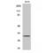 TIMP Metallopeptidase Inhibitor 3 antibody, LS-C386443, Lifespan Biosciences, Western Blot image 