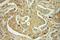 Oligophrenin 1 antibody, 11076-1-AP, Proteintech Group, Immunohistochemistry paraffin image 