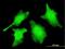Caspase 2 antibody, H00000835-M10, Novus Biologicals, Immunocytochemistry image 