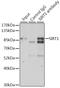 Sirtuin 1 antibody, LS-C746926, Lifespan Biosciences, Immunoprecipitation image 