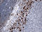 Cathepsin L antibody, LS-C796474, Lifespan Biosciences, Immunohistochemistry paraffin image 