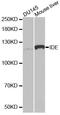 Insulin-degrading enzyme antibody, A1630, ABclonal Technology, Western Blot image 