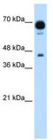 Pseudouridine Synthase 7 antibody, TA339348, Origene, Western Blot image 