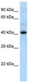 Keratin 36 antibody, TA343127, Origene, Western Blot image 