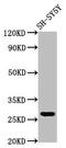 CD99 Molecule Like 2 antibody, CSB-PA840569LA01HU, Cusabio, Western Blot image 